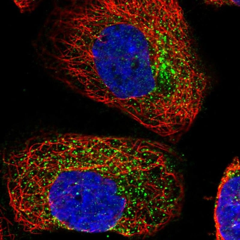ACRC Antibody - BSA Free Immunocytochemistry/ Immunofluorescence: ACRC Antibody [NBP1-85993]