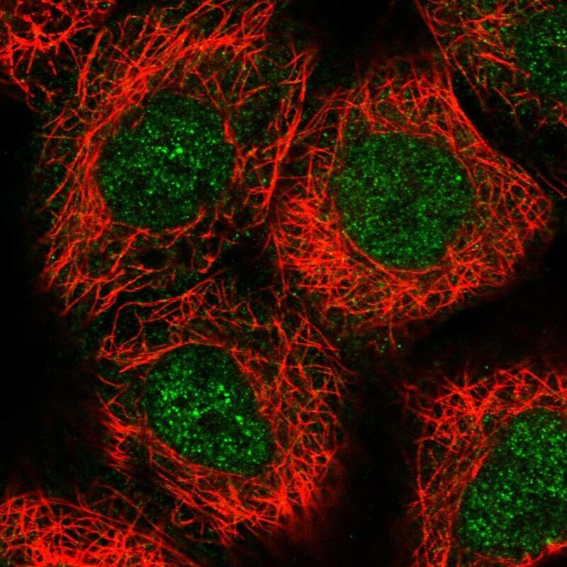 Archaemetzincin 2 Antibody - BSA Free Immunocytochemistry/ Immunofluorescence: Archaemetzincin 2 Antibody - BSA Free [NBP1-85996]