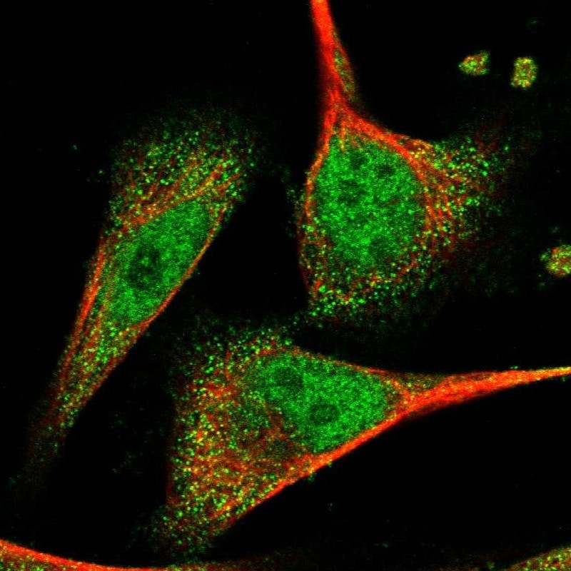 CNPase Antibody - BSA Free Immunocytochemistry/ Immunofluorescence: CNPase Antibody - BSA Free [NBP1-85997]