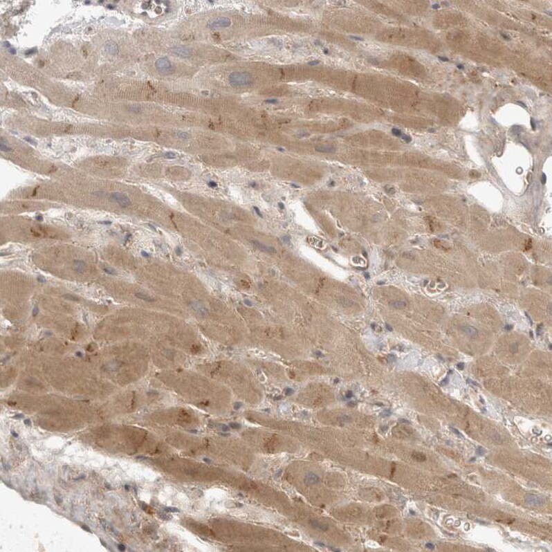 TOM1L2 Antibody - BSA Free Immunohistochemistry-Paraffin: TOM1L2 Antibody - BSA Free [NBP1-86006]