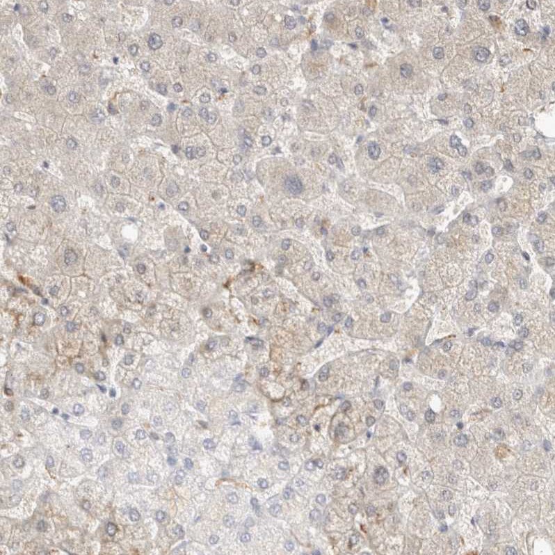 TOM1L2 Antibody - BSA Free Immunohistochemistry-Paraffin: TOM1L2 Antibody - BSA Free [NBP1-86006]