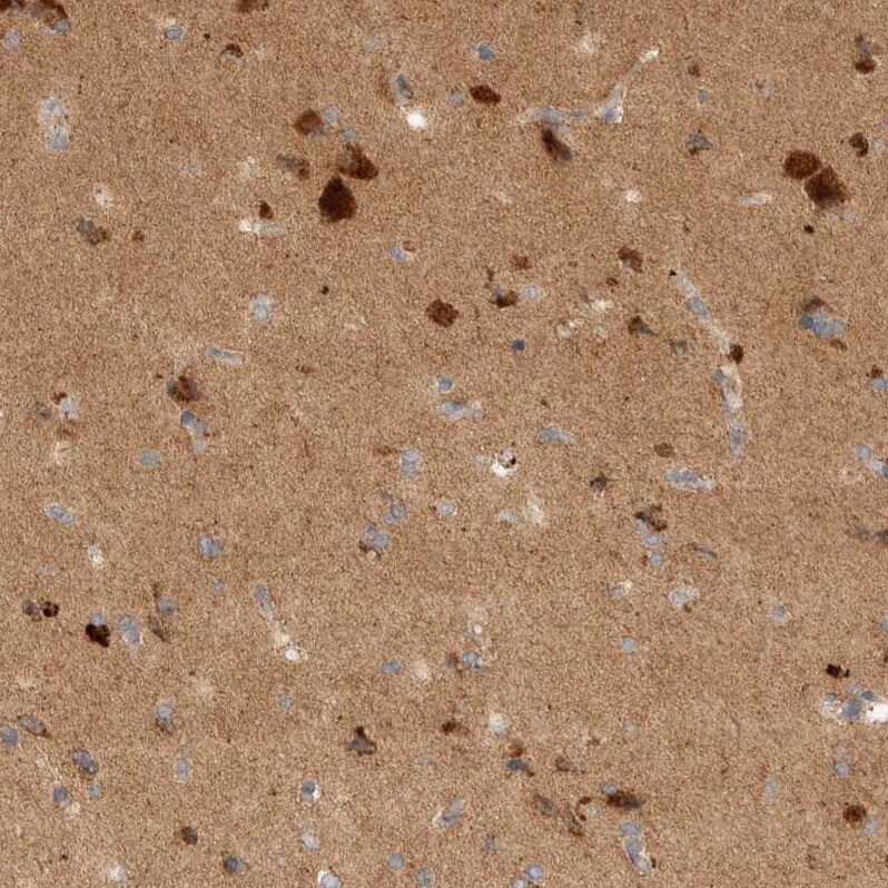 TOM1L2 Antibody - BSA Free Immunohistochemistry-Paraffin: TOM1L2 Antibody - BSA Free [NBP1-86006]