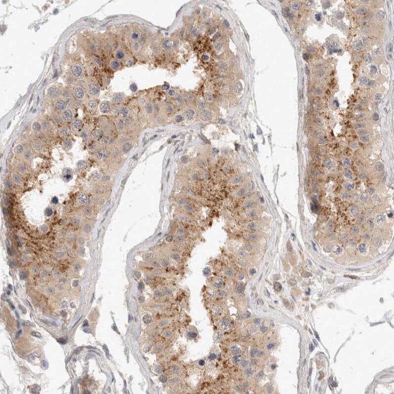 TOM1L2 Antibody - BSA Free Immunohistochemistry-Paraffin: TOM1L2 Antibody - BSA Free [NBP1-86006]