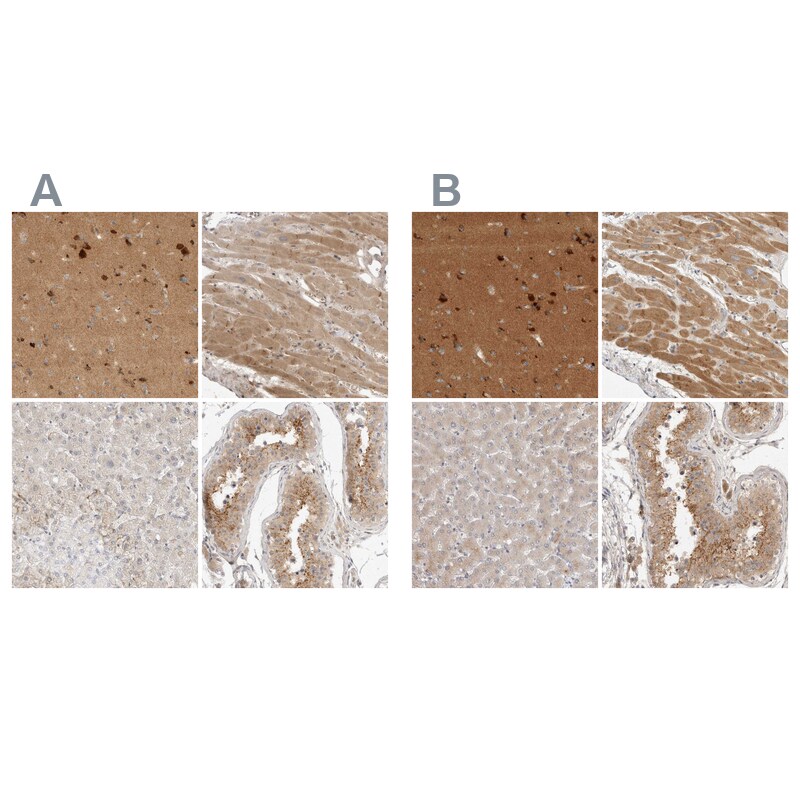 TOM1L2 Antibody - BSA Free Immunohistochemistry-Paraffin: TOM1L2 Antibody - BSA Free [NBP1-86006]
