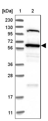 TOM1L2 Antibody - BSA Free Western Blot: TOM1L2 Antibody - BSA Free [NBP1-86006]