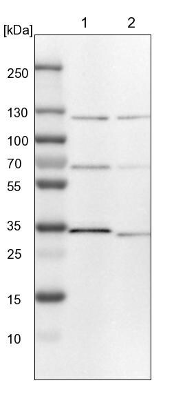TOM1L2 Antibody - BSA Free Western Blot: TOM1L2 Antibody - BSA Free [NBP1-86006]