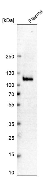 Plasminogen Antibody - BSA Free Western Blot: Plasminogen Antibody - BSA Free [NBP1-86015]