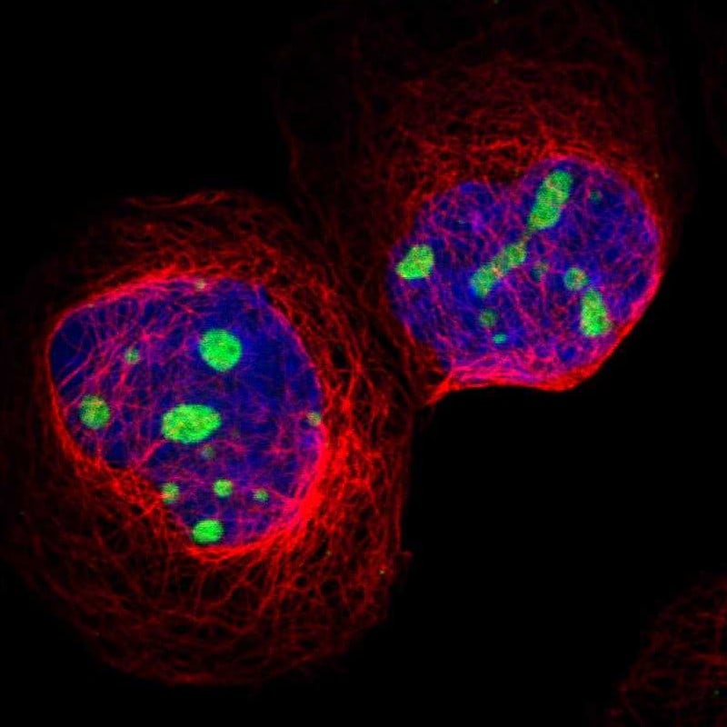CPS1 Antibody - BSA Free Immunocytochemistry/ Immunofluorescence: CPS1 Antibody [NBP1-86019]