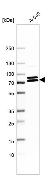 KIFC3 Antibody - BSA Free Western Blot: KIFC3 Antibody - BSA Free [NBP1-86021]