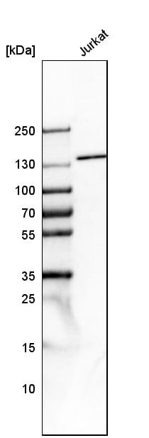 Tripeptidyl peptidase II Antibody - BSA Free Western Blot: Tripeptidyl peptidase II Antibody - BSA Free [NBP1-86022]