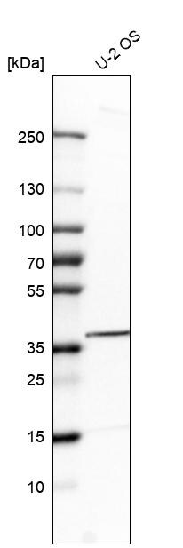 Tyrosylprotein Sulfotransferase 2/TPST2 Antibody - BSA Free Western Blot: Tyrosylprotein Sulfotransferase 2/TPST2 Antibody - BSA Free [NBP1-86023]