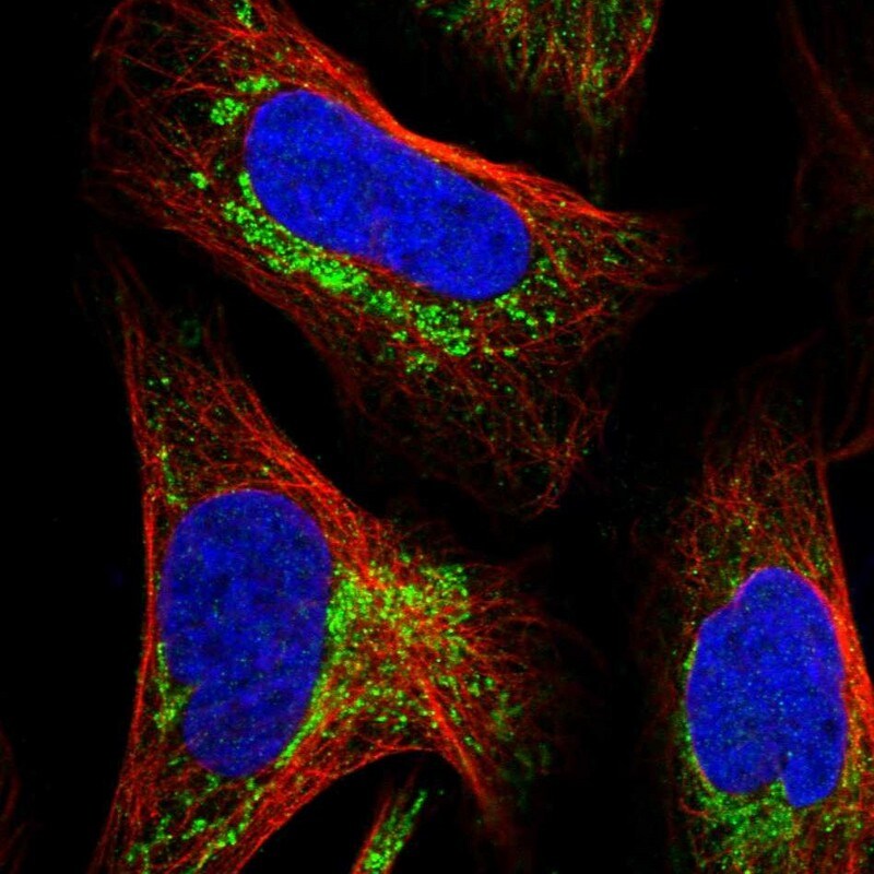 MALSU1 Antibody - BSA Free Immunocytochemistry/ Immunofluorescence: MALSU1 Antibody [NBP1-86026]