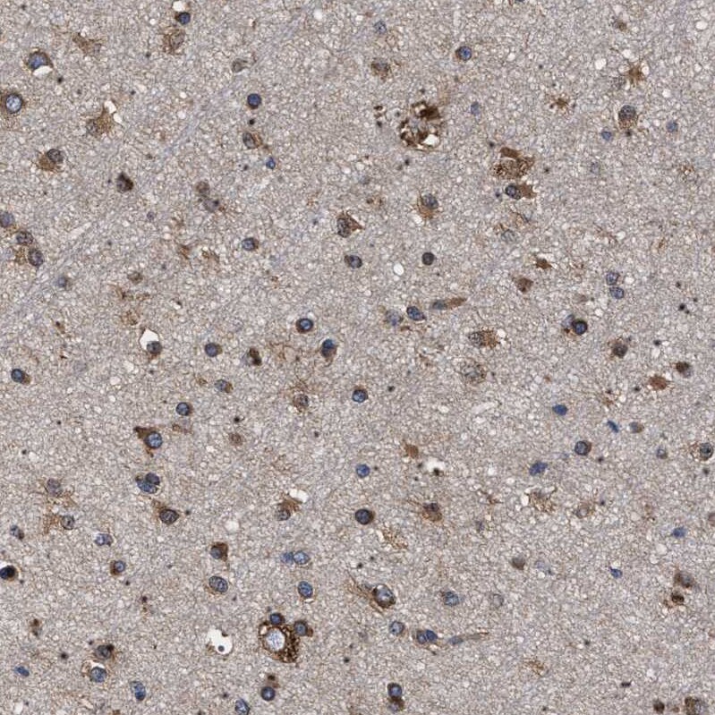 DARS Antibody - BSA Free Immunohistochemistry-Paraffin: DARS Antibody - BSA Free [NBP1-86027]