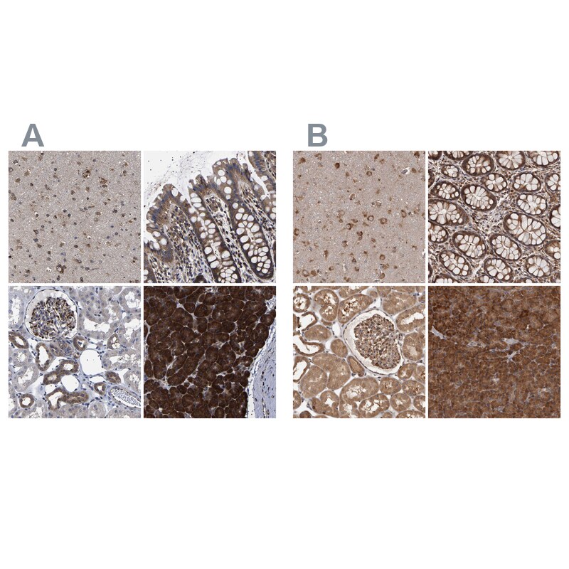 DARS Antibody - BSA Free Immunohistochemistry-Paraffin: DARS Antibody - BSA Free [NBP1-86027]