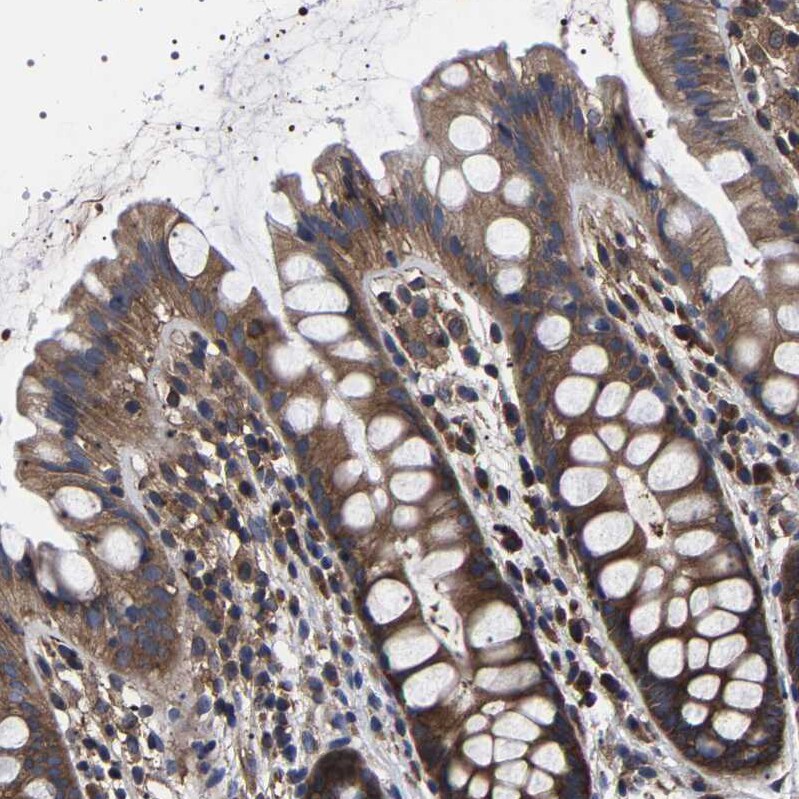 DARS Antibody - BSA Free Immunohistochemistry-Paraffin: DARS Antibody - BSA Free [NBP1-86027]