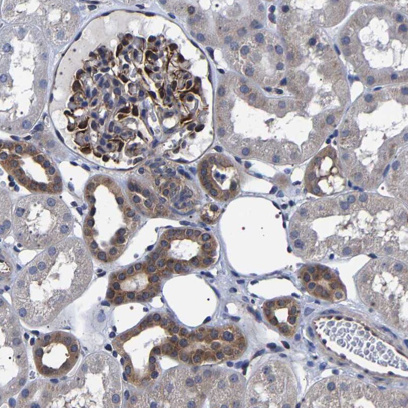 DARS Antibody - BSA Free Immunohistochemistry-Paraffin: DARS Antibody - BSA Free [NBP1-86027]