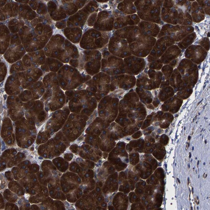 DARS Antibody - BSA Free Immunohistochemistry-Paraffin: DARS Antibody - BSA Free [NBP1-86027]