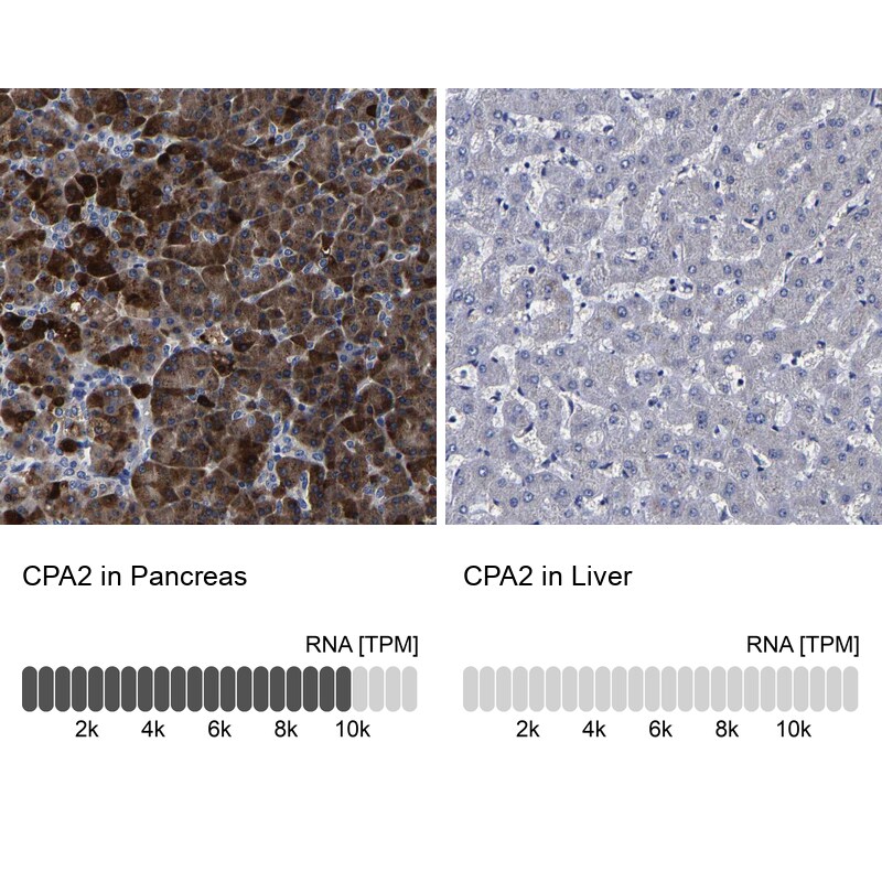 Carboxypeptidase A2/CPA2 Antibody - BSA Free Immunohistochemistry-Paraffin: Carboxypeptidase A2/CPA2 Antibody [NBP1-86028]