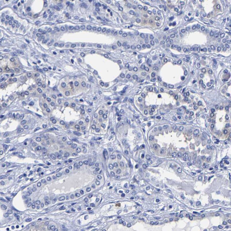 Carboxypeptidase A2/CPA2 Antibody - BSA Free Immunohistochemistry-Paraffin: Carboxypeptidase A2/CPA2 Antibody [NBP1-86028]