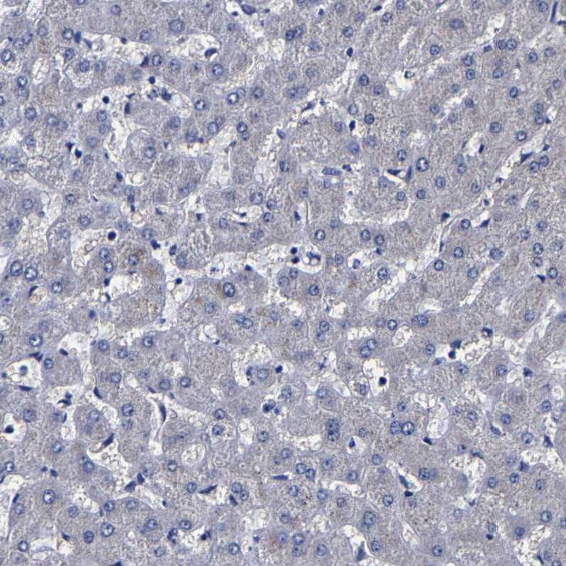 Carboxypeptidase A2/CPA2 Antibody - BSA Free Immunohistochemistry-Paraffin: Carboxypeptidase A2/CPA2 Antibody [NBP1-86028]