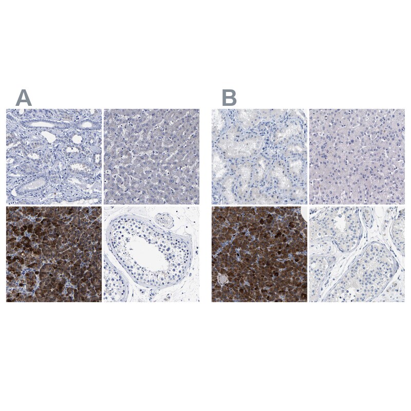 Carboxypeptidase A2/CPA2 Antibody - BSA Free Immunohistochemistry-Paraffin: Carboxypeptidase A2/CPA2 Antibody [NBP1-86028]