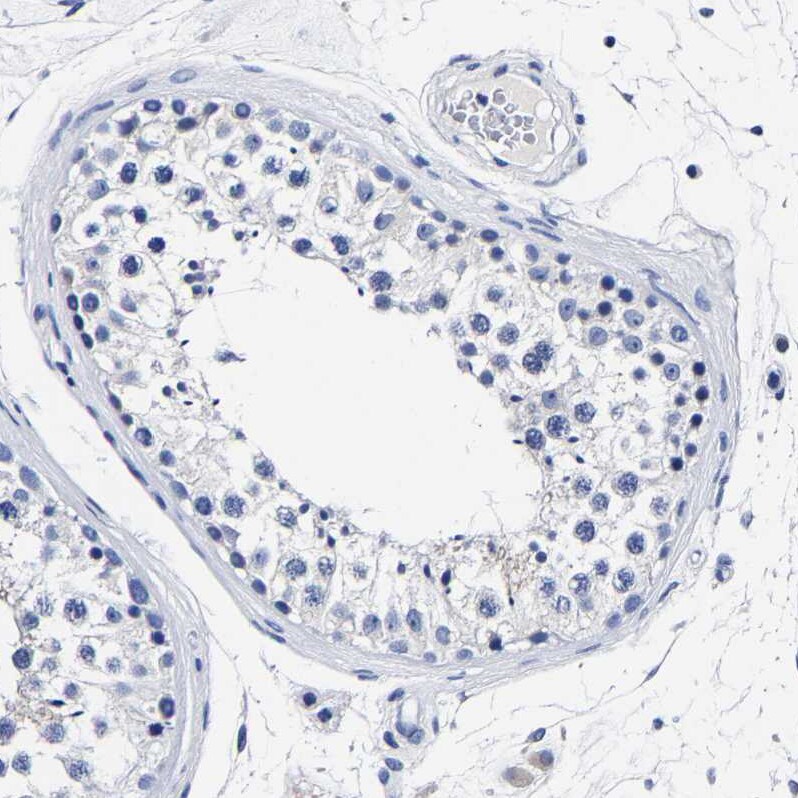 Carboxypeptidase A2/CPA2 Antibody - BSA Free Immunohistochemistry-Paraffin: Carboxypeptidase A2/CPA2 Antibody - BSA Free [NBP1-86028]