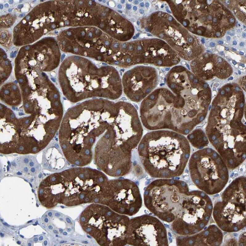 58K Golgi Protein Antibody - BSA Free Immunohistochemistry-Paraffin: 58K Golgi Protein Antibody - BSA Free [NBP1-86031]