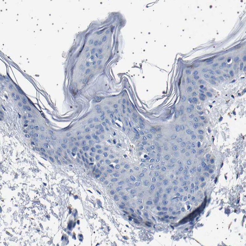 58K Golgi Protein Antibody - BSA Free Immunohistochemistry-Paraffin: 58K Golgi Protein Antibody - BSA Free [NBP1-86031]