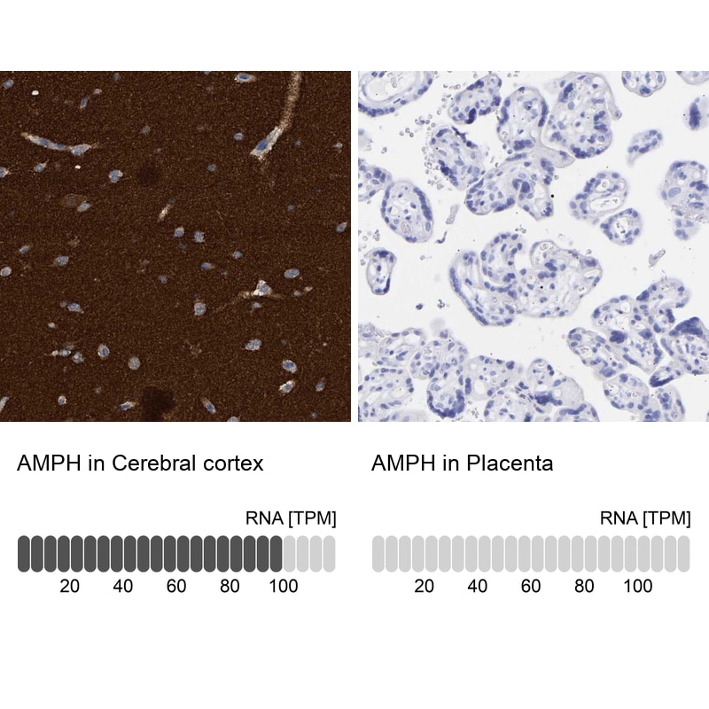 Amphiphysin/AMPH Antibody - BSA Free Immunohistochemistry-Paraffin: Amphiphysin/AMPH Antibody - BSA Free [NBP1-86033]