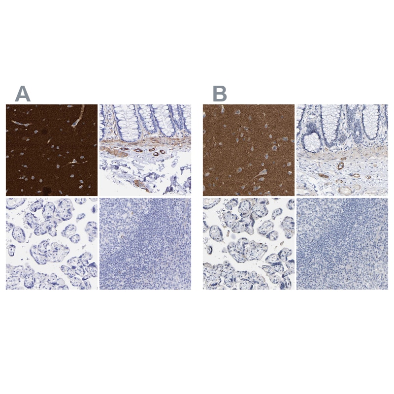 Amphiphysin/AMPH Antibody - BSA Free Immunohistochemistry-Paraffin: Amphiphysin/AMPH Antibody - BSA Free [NBP1-86033]