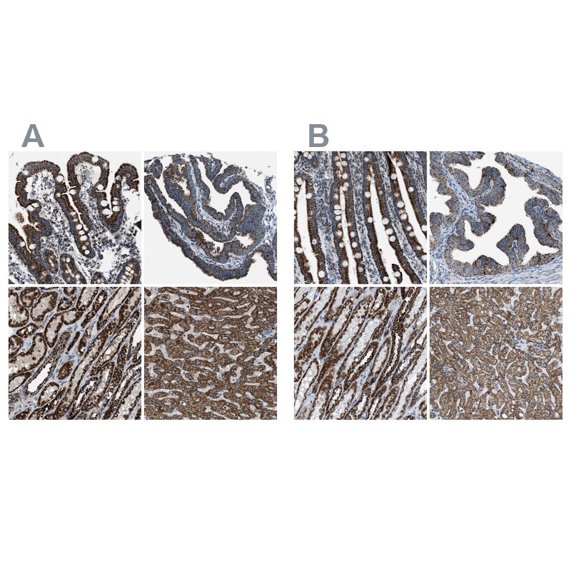 MDH2 Antibody - BSA Free Immunohistochemistry-Paraffin: MDH2 Antibody - BSA Free [NBP1-86036]
