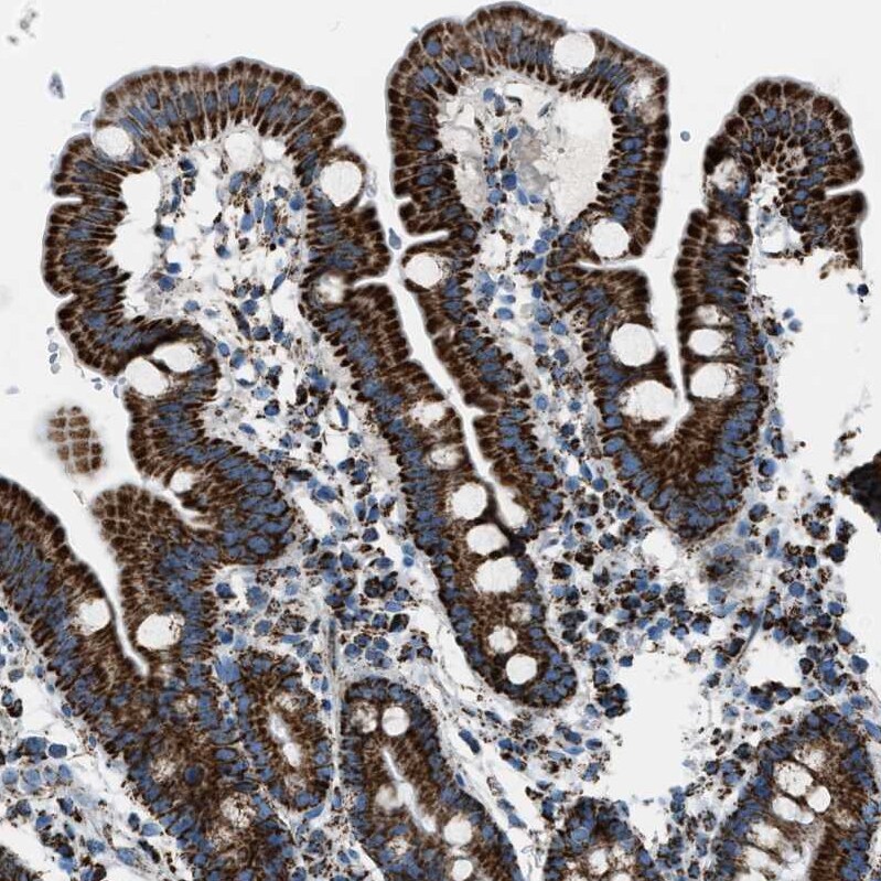 MDH2 Antibody - BSA Free Immunohistochemistry-Paraffin: MDH2 Antibody - BSA Free [NBP1-86036]