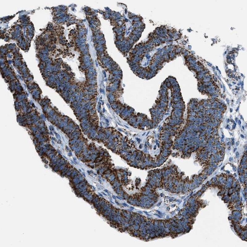 MDH2 Antibody - BSA Free Immunohistochemistry-Paraffin: MDH2 Antibody - BSA Free [NBP1-86036]