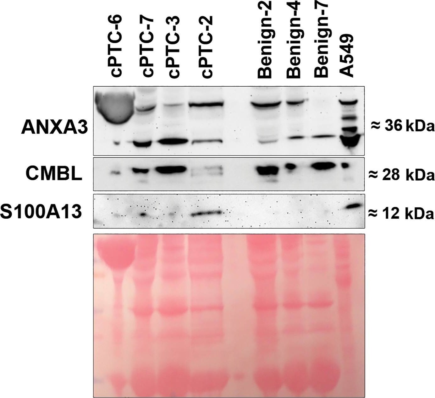 S100A13 Antibody