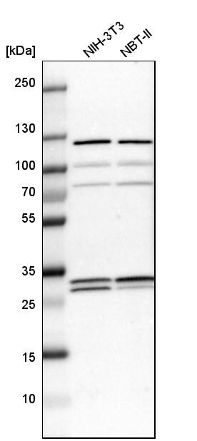 ETFB Antibody - BSA Free Western Blot: ETFB Antibody - BSA Free [NBP1-86040]
