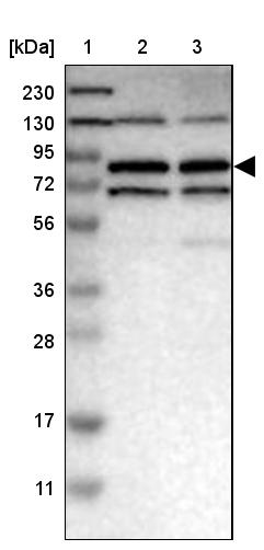 MTMR1 Antibody - BSA Free Western Blot: MTMR1 Antibody - BSA Free [NBP1-86042]