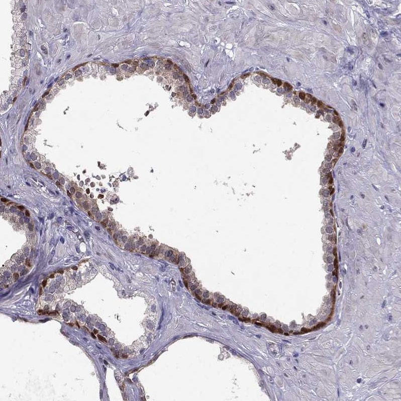 RTDR1 Antibody - BSA Free Immunohistochemistry-Paraffin: RTDR1 Antibody - BSA Free [NBP1-86045]