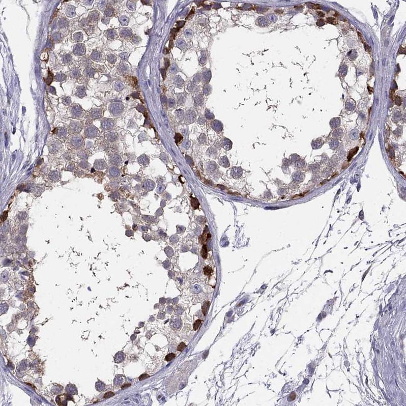 RTDR1 Antibody - BSA Free Immunohistochemistry-Paraffin: RTDR1 Antibody - BSA Free [NBP1-86045]