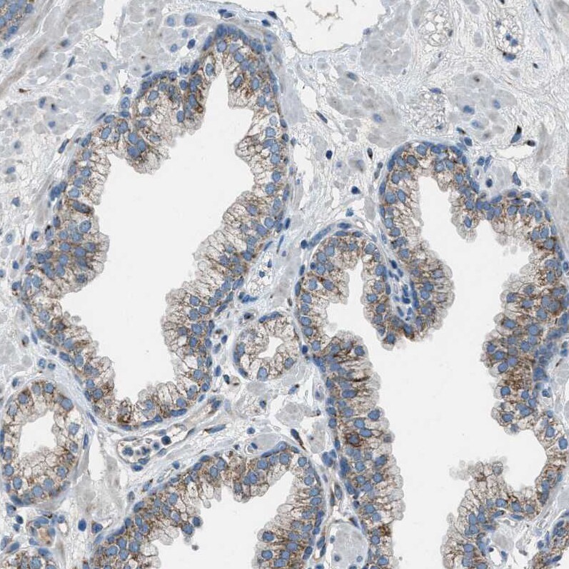 BCKDK Antibody - BSA Free Immunohistochemistry-Paraffin: BCKDK Antibody - BSA Free [NBP1-86052]