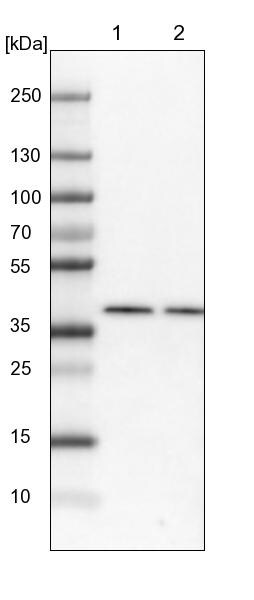 BCKDK Antibody - BSA Free Western Blot: BCKDK Antibody - BSA Free [NBP1-86052]