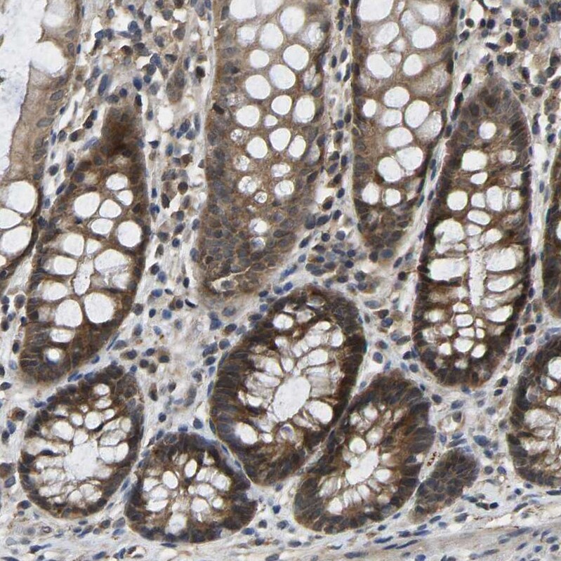 NDRG3 Antibody - BSA Free Immunohistochemistry-Paraffin: NDRG3 Antibody - BSA Free [NBP1-86054]