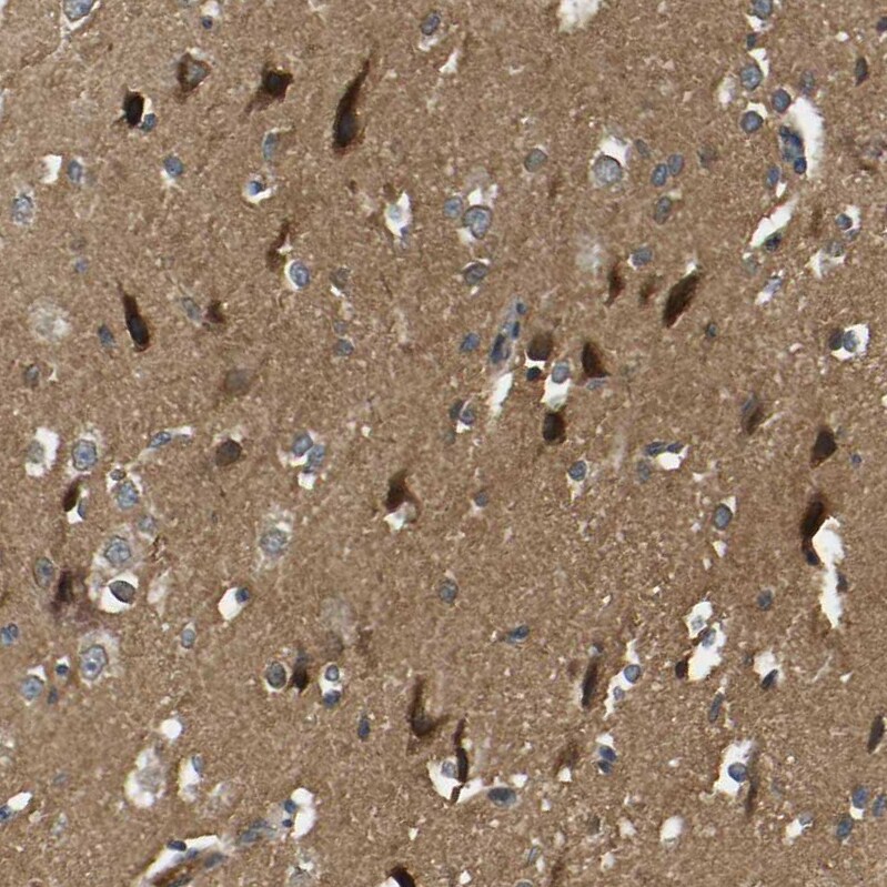NDRG3 Antibody - BSA Free Immunohistochemistry-Paraffin: NDRG3 Antibody - BSA Free [NBP1-86054]