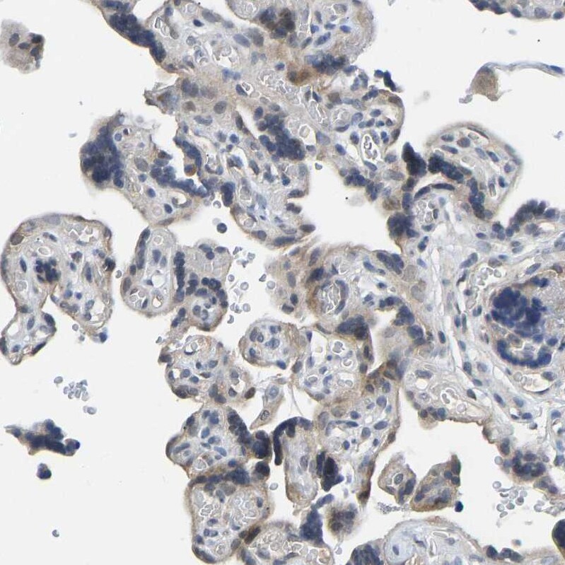 NDRG3 Antibody - BSA Free Immunohistochemistry-Paraffin: NDRG3 Antibody - BSA Free [NBP1-86054]