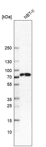 CTPS2 Antibody - BSA Free Western Blot: CTPS2 Antibody - BSA Free [NBP1-86055]