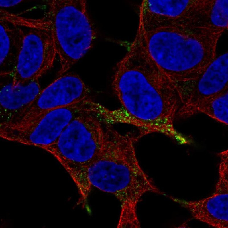 Chromogranin A Antibody - BSA Free Immunocytochemistry/ Immunofluorescence: Chromogranin A Antibody [NBP1-86056]
