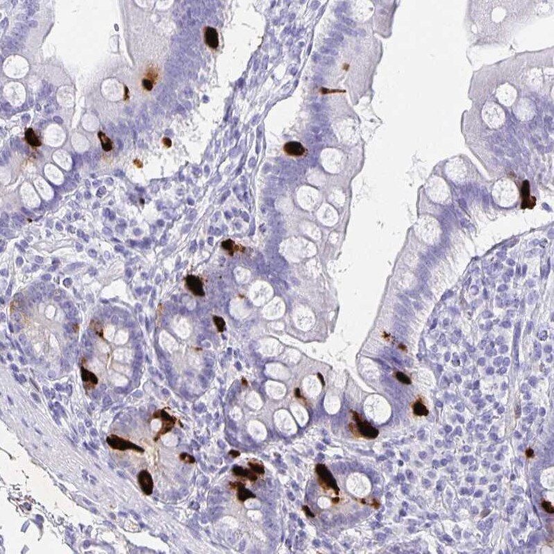 Chromogranin A Antibody - BSA Free Immunohistochemistry-Paraffin: Chromogranin A Antibody - BSA Free [NBP1-86056]