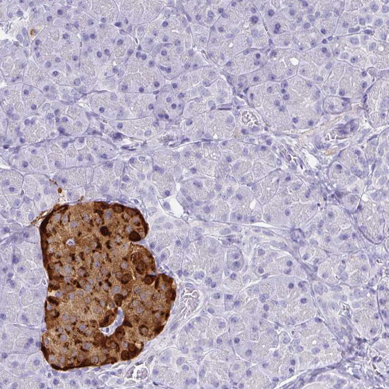 Chromogranin A Antibody - BSA Free Immunohistochemistry-Paraffin: Chromogranin A Antibody - BSA Free [NBP1-86056]