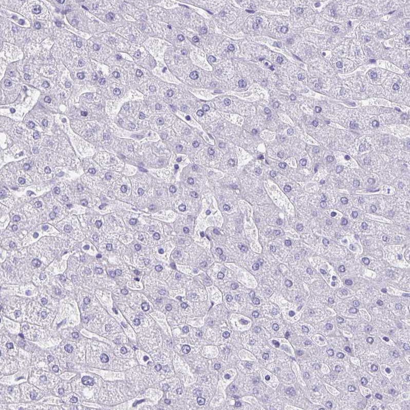Chromogranin A Antibody - BSA Free Immunohistochemistry-Paraffin: Chromogranin A Antibody - BSA Free [NBP1-86056]