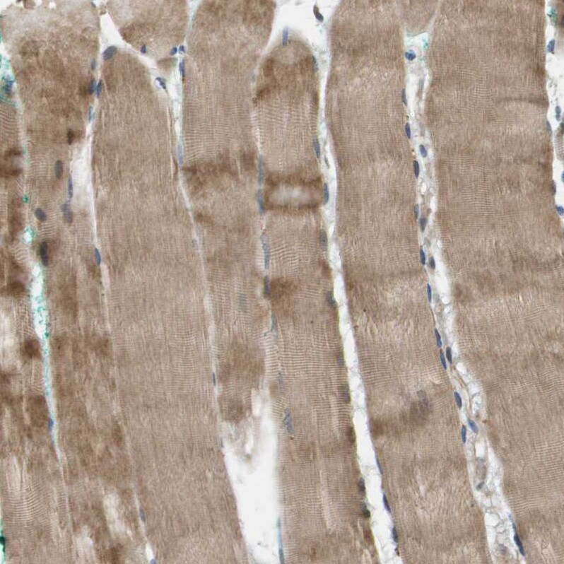 SCN4B Antibody - BSA Free Immunohistochemistry-Paraffin: SCN4B Antibody - BSA Free [NBP1-86057]