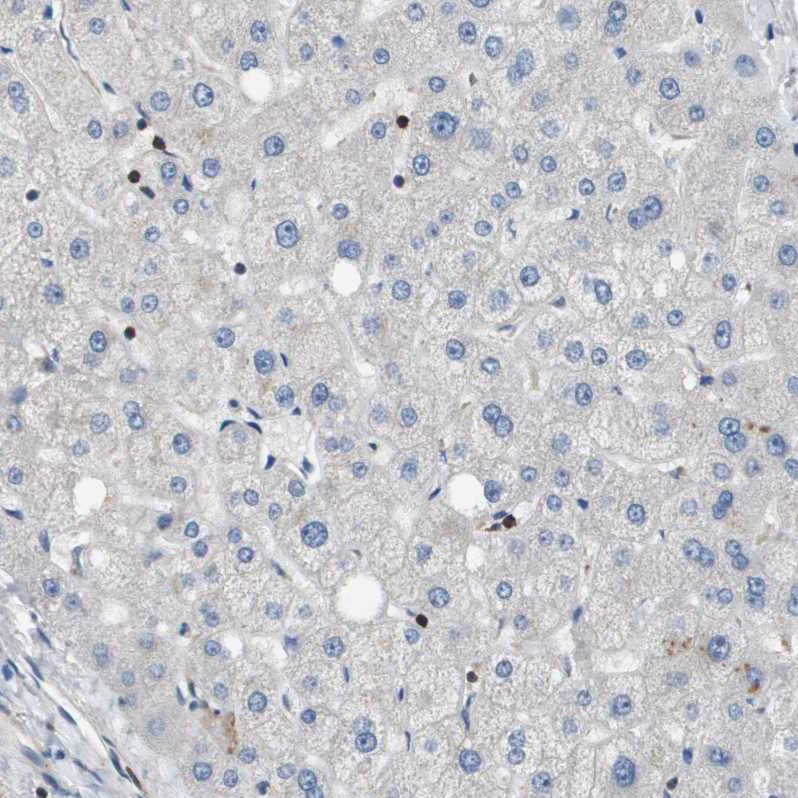 SCN4B Antibody - BSA Free Immunohistochemistry-Paraffin: SCN4B Antibody - BSA Free [NBP1-86057]